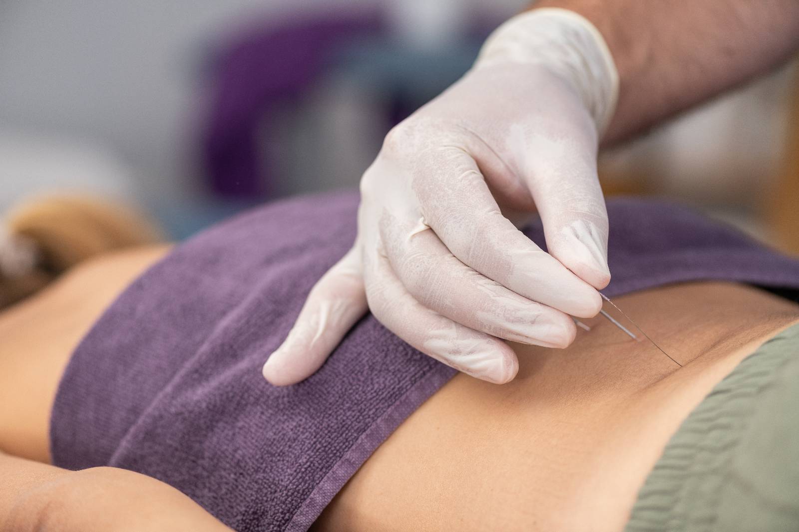 A physical therapist dry needling a patient.